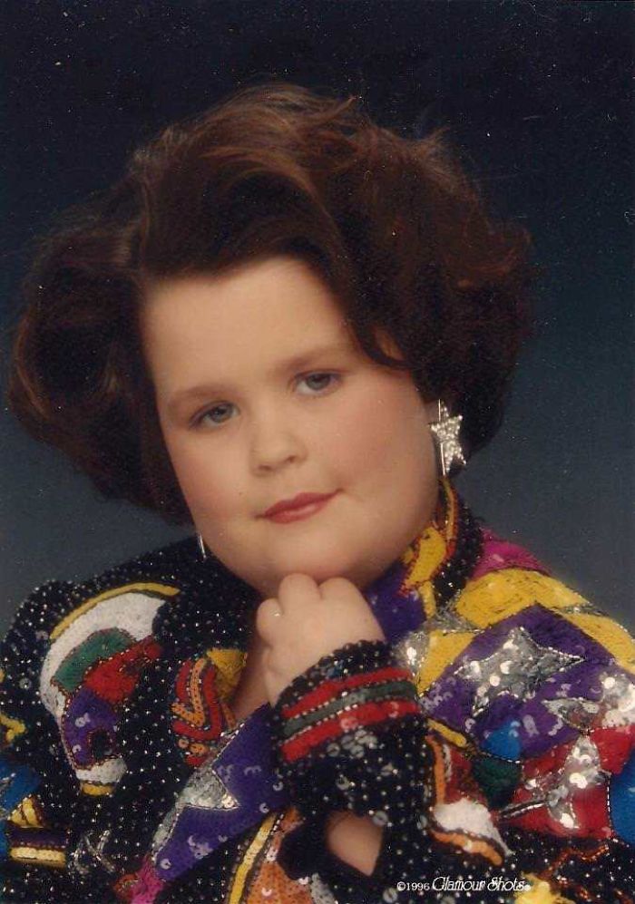embarrassing childhood photos