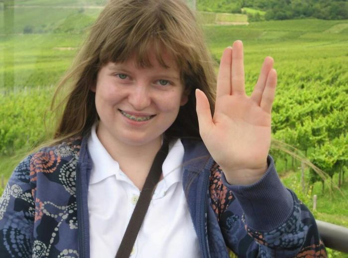 embarrassing childhood photos