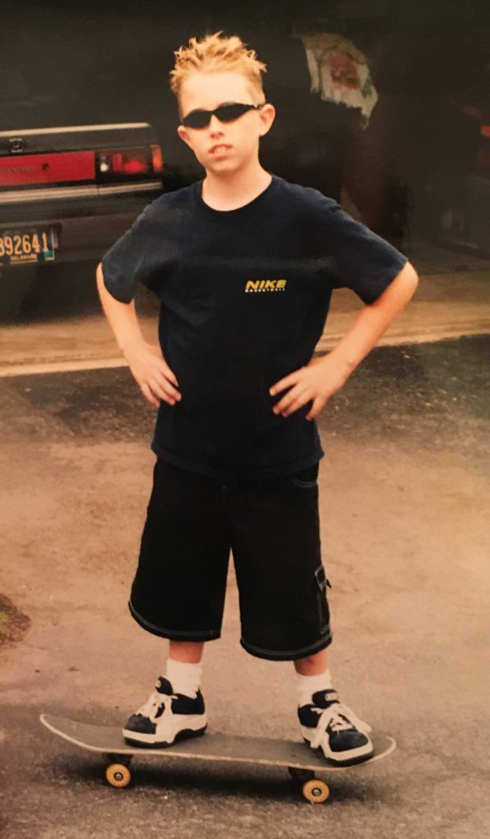 embarrassing childhood photos